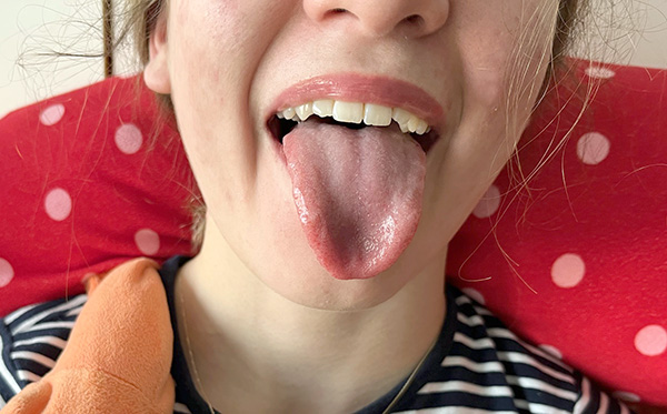 Как нарушенията на артикулацията се отразяват върху писането